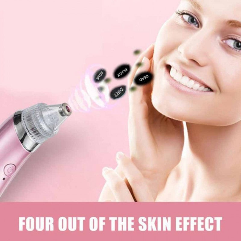 Blackhead Remover | 5 مستويات شفط، مزيل رؤوس سوداء قابل لإعادة الشحن عبر USB