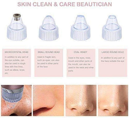 Blackhead Remover | 5 مستويات شفط، مزيل رؤوس سوداء قابل لإعادة الشحن عبر USB