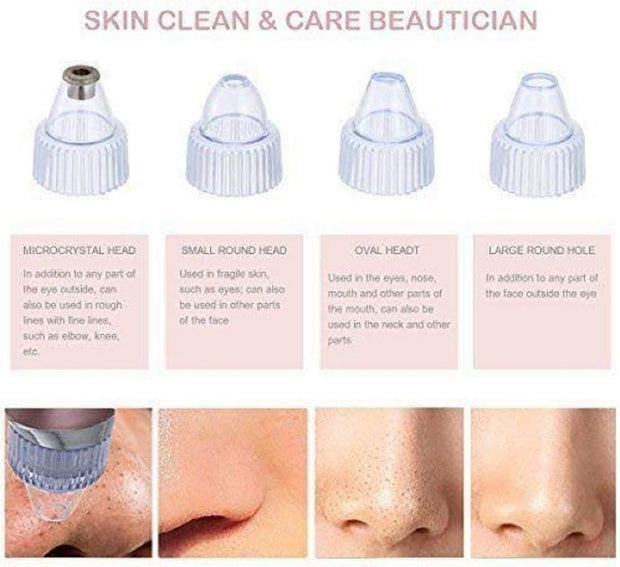 5 Suction Levels, USB Rechargeable Blackhead Remover | 5 مستويات شفط، مزيل رؤوس سوداء قابل لإعادة الشحن عبر USB