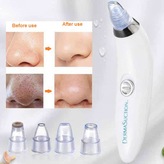 5 Suction Levels, USB Rechargeable Blackhead Remover | 5 مستويات شفط، مزيل رؤوس سوداء قابل لإعادة الشحن عبر USB