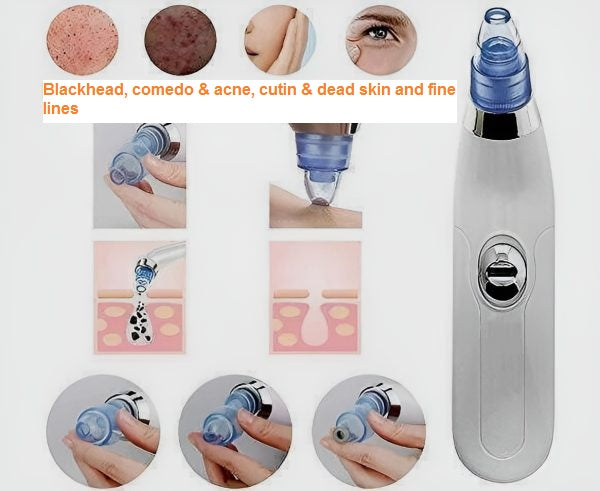5 Suction Levels, USB Rechargeable Blackhead Remover | 5 مستويات شفط، مزيل رؤوس سوداء قابل لإعادة الشحن عبر USB