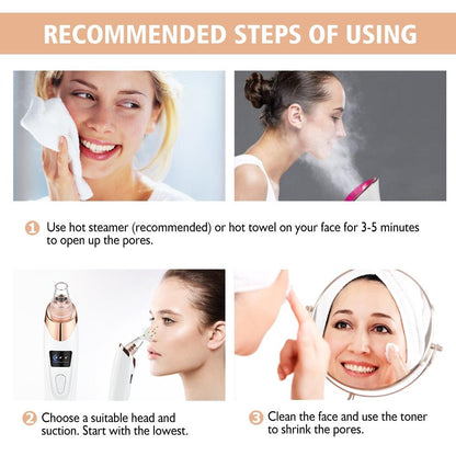 Blackhead Remover | 5 مستويات شفط، مزيل رؤوس سوداء قابل لإعادة الشحن عبر USB